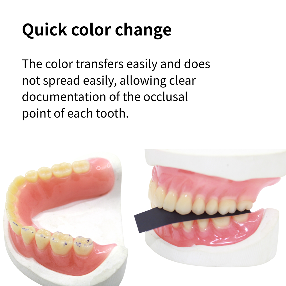 AG 300枚入り/箱 歯科用咬合紙ストリップ 赤/青 歯科 - Teeth Whitening Strips のレビューと価格